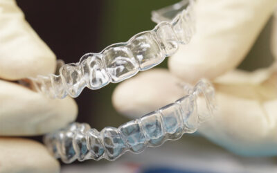Read This Before Ordering Orthodontic Treatment Online