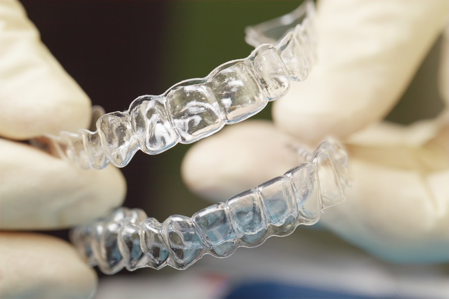 Read This Before Ordering Orthodontic Treatment Online